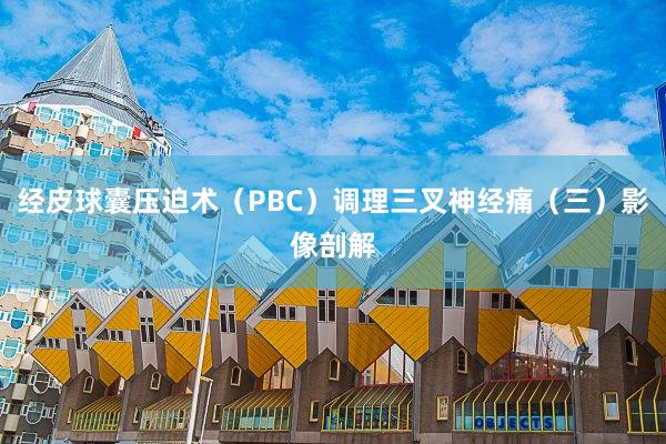 经皮球囊压迫术（PBC）调理三叉神经痛（三）影像剖解